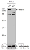Anti-ATG14 antibody used in Western Blot (WB). GTX119950