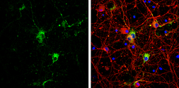Anti-Syntabulin antibody used in Immunocytochemistry/ Immunofluorescence (ICC/IF). GTX119953