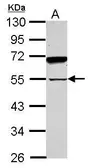 Anti-SPAG8 antibody used in Western Blot (WB). GTX119963