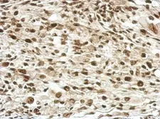 Anti-RPRD1B antibody used in IHC (Paraffin sections) (IHC-P). GTX119969