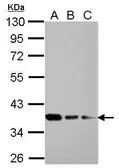 Anti-RPRD1B antibody used in Western Blot (WB). GTX119969