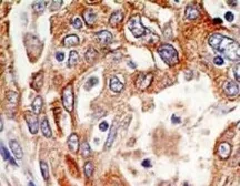 Anti-p73 delta N antibody [38C674.2] used in IHC (Paraffin sections) (IHC-P). GTX11997