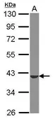 Anti-ST6GALNAC4 antibody [N2C3] used in Western Blot (WB). GTX119976