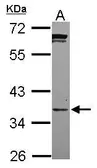 Anti-PPCS antibody [N2C3] used in Western Blot (WB). GTX119988