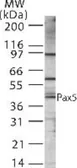 Anti-PAX5 antibody used in Western Blot (WB). GTX12000