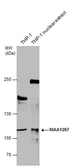 Anti-KIAA1267 antibody [N1N2], N-term used in Western Blot (WB). GTX120002