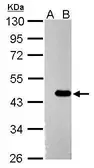 Anti-ZBTB24 antibody used in Western Blot (WB). GTX120013