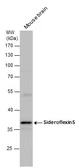 Anti-Sideroflexin 5 antibody used in Western Blot (WB). GTX120024