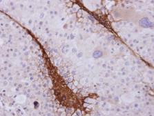 Anti-ST3GAL3 antibody used in IHC (Paraffin sections) (IHC-P). GTX120029