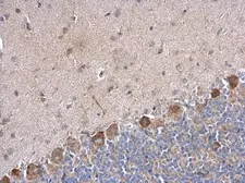 Anti-PABPC5 antibody used in IHC (Paraffin sections) (IHC-P). GTX120031