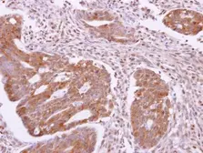 Anti-SH3GLB2 antibody used in IHC (Paraffin sections) (IHC-P). GTX120037