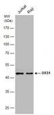 Anti-UXS1 antibody [N3C3] used in Western Blot (WB). GTX120038