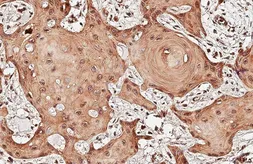 Anti-UXS1 antibody [N3C3] used in IHC (Paraffin sections) (IHC-P). GTX120038