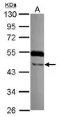 Anti-TTLL10 antibody [N3C2], Internal used in Western Blot (WB). GTX120045