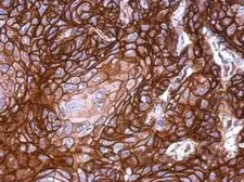 Anti-KLHDC5 antibody used in IHC (Paraffin sections) (IHC-P). GTX120046