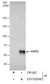 Anti-USP22 antibody [N3C3] used in Immunoprecipitation (IP). GTX120048