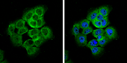 Anti-AMOTL2 antibody [C1C3] used in Immunocytochemistry/ Immunofluorescence (ICC/IF). GTX120057