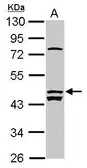 Anti-ALS2CR12 antibody used in Western Blot (WB). GTX120076