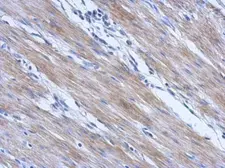 Anti-CCDC17 antibody [C1C3] used in IHC (Paraffin sections) (IHC-P). GTX120083