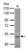 Anti-CCDC17 antibody [C1C3] used in Western Blot (WB). GTX120083