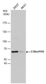 Anti-MCMBP antibody used in Western Blot (WB). GTX120103