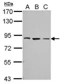 Anti-THOC5 antibody used in Western Blot (WB). GTX120113