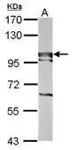 Anti-BOP1 antibody [N3C3] used in Western Blot (WB). GTX120120