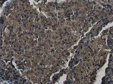 Anti-ZC3HAV1 antibody [N3C2], Internal used in IHC (Paraffin sections) (IHC-P). GTX120134