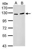 Anti-ZNF711 antibody used in Western Blot (WB). GTX120140