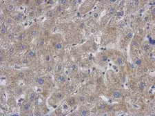 Anti-GCC1 antibody [C1C3] used in IHC (Paraffin sections) (IHC-P). GTX120148