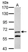 Anti-KLHL13 antibody [N3C2], Internal used in Western Blot (WB). GTX120173