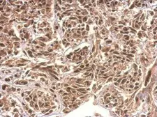 Anti-KIAA0323 antibody [C2C3], C-term used in IHC (Paraffin sections) (IHC-P). GTX120182