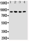 Anti-NRG2 antibody used in Western Blot (WB). GTX12019