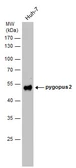 Anti-Pygopus 2 antibody used in Western Blot (WB). GTX120215