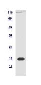 Mouse OVOL2 protein, His tag. GTX120218-pro