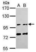 Anti-FAM171A1 antibody [C1C3] used in Western Blot (WB). GTX120226