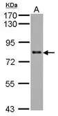 Anti-KCTD3 antibody [C2C3], C-term used in Western Blot (WB). GTX120229