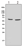 Anti-NOX2 / gp91phox antibody used in Western Blot (WB). GTX12024
