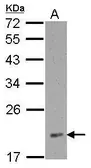 Anti-RPL12 antibody used in Western Blot (WB). GTX120265