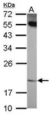Anti-ANKRD39 antibody [N1C3] used in Western Blot (WB). GTX120277