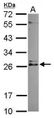 Anti-IMP3 antibody [N1C3] used in Western Blot (WB). GTX120291