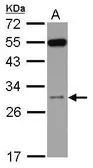 Anti-RPS8 antibody [N1C3] used in Western Blot (WB). GTX120300