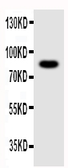 Anti-NLRP4G antibody used in Western Blot (WB). GTX12032