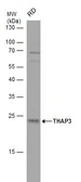 Anti-THAP3 antibody used in Western Blot (WB). GTX120323