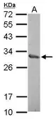 Anti-ZNF414 antibody [N1C1] used in Western Blot (WB). GTX120358