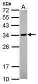 Anti-C18orf10 antibody used in Western Blot (WB). GTX120361