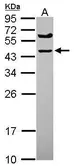 Anti-SPRYD5 antibody [C1C3] used in Western Blot (WB). GTX120369