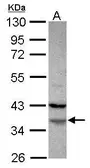 Anti-FAM76A antibody [N3C3] used in Western Blot (WB). GTX120378