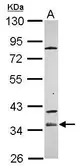 Anti-ZP1 antibody [C1C3] used in Western Blot (WB). GTX120384
