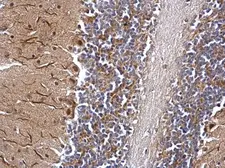 Anti-DNTTIP1 antibody used in IHC (Paraffin sections) (IHC-P). GTX120392